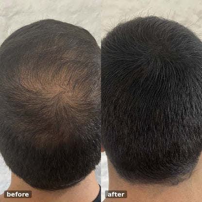 Hairtopup Hair Concealer 50ML - Waterproof 3–7 days.